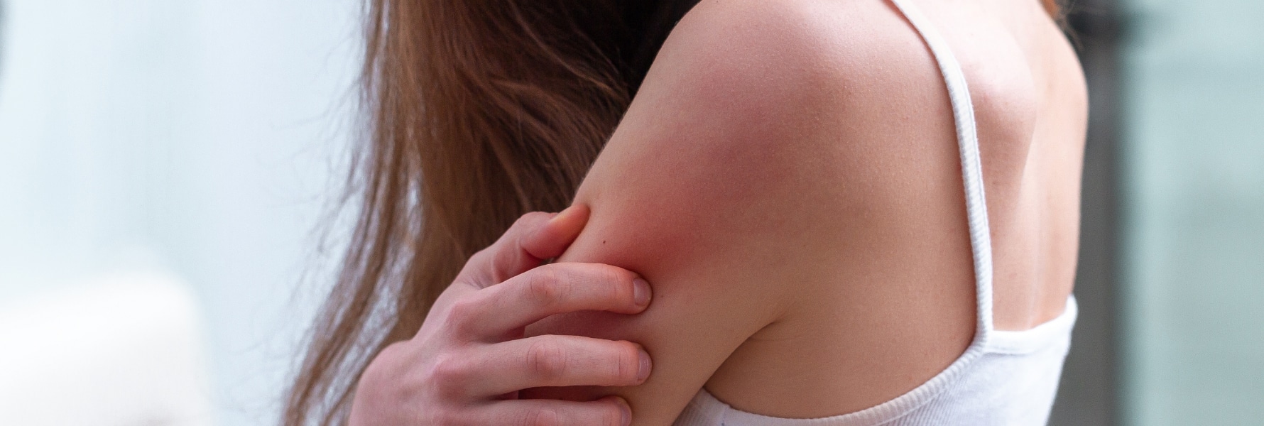 Contact Dermatitis Plantation FL