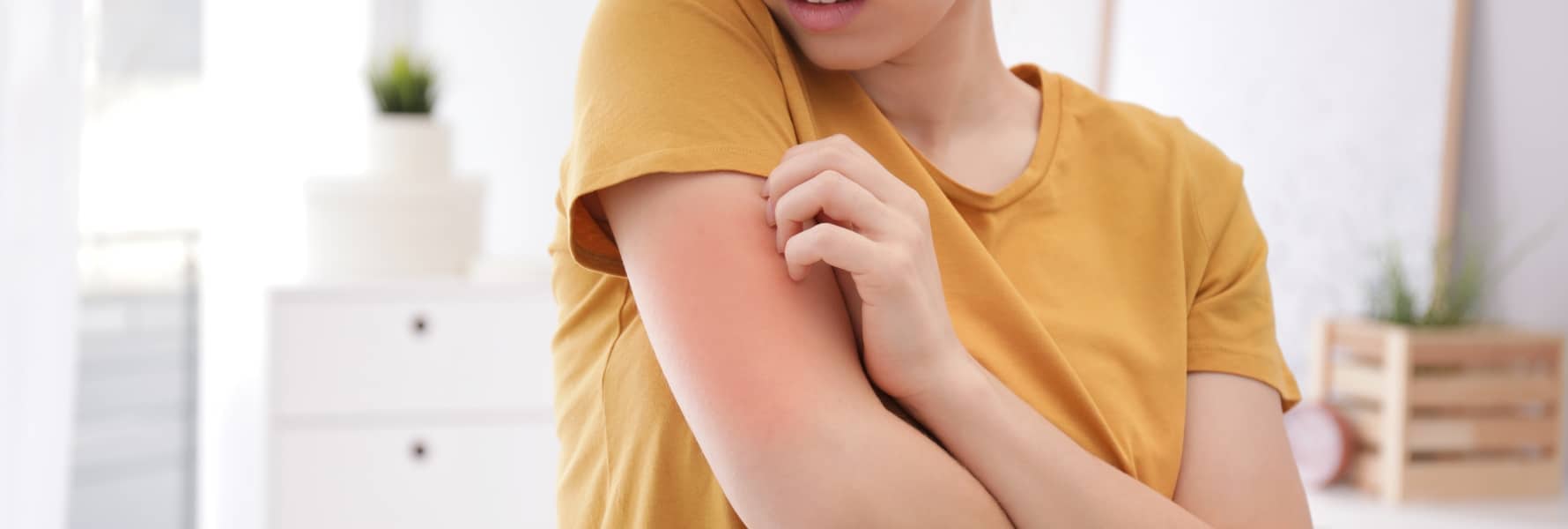 Eczema Treatment Plantation FL