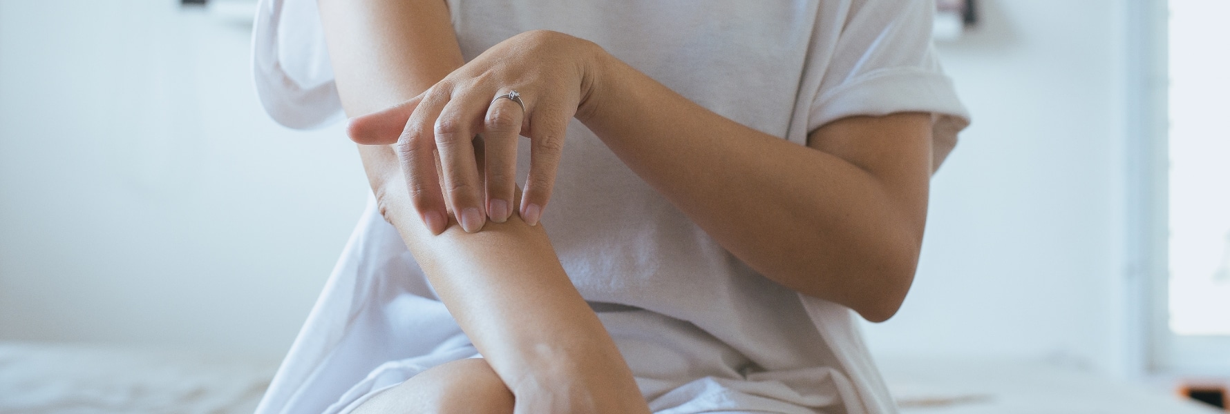 Psoriasis Treatment Plantation FL
